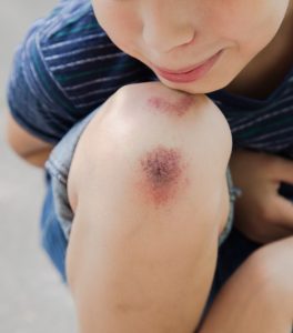 موارد مصرف ستریماید سی