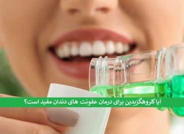 خرید کلروهگزیدین