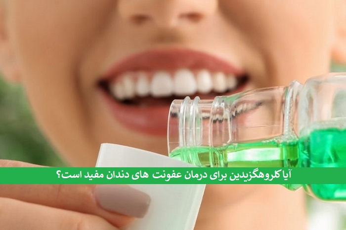 خرید کلروهگزیدین